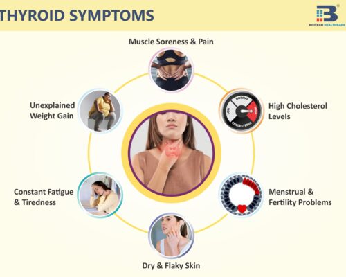 Prevent & Treat Thyroid With These Tips & Tricks